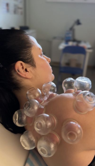 Profesjonalne masaże/ Stawianie baniek/ Masaż bańką