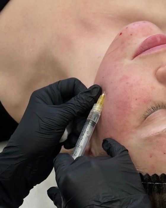 Косметолог | Київ, Позняки