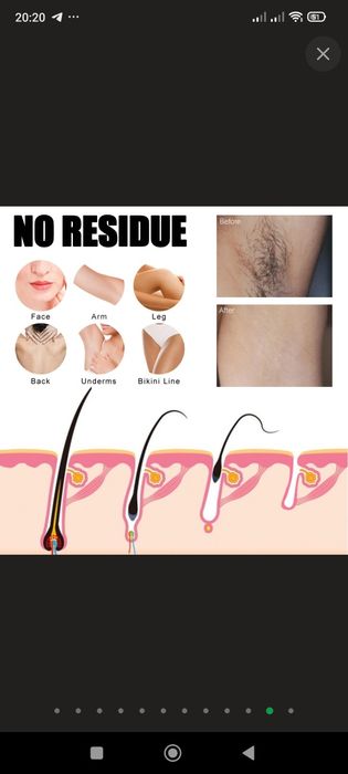 Спрей для удаления волос Eelhoe!!!