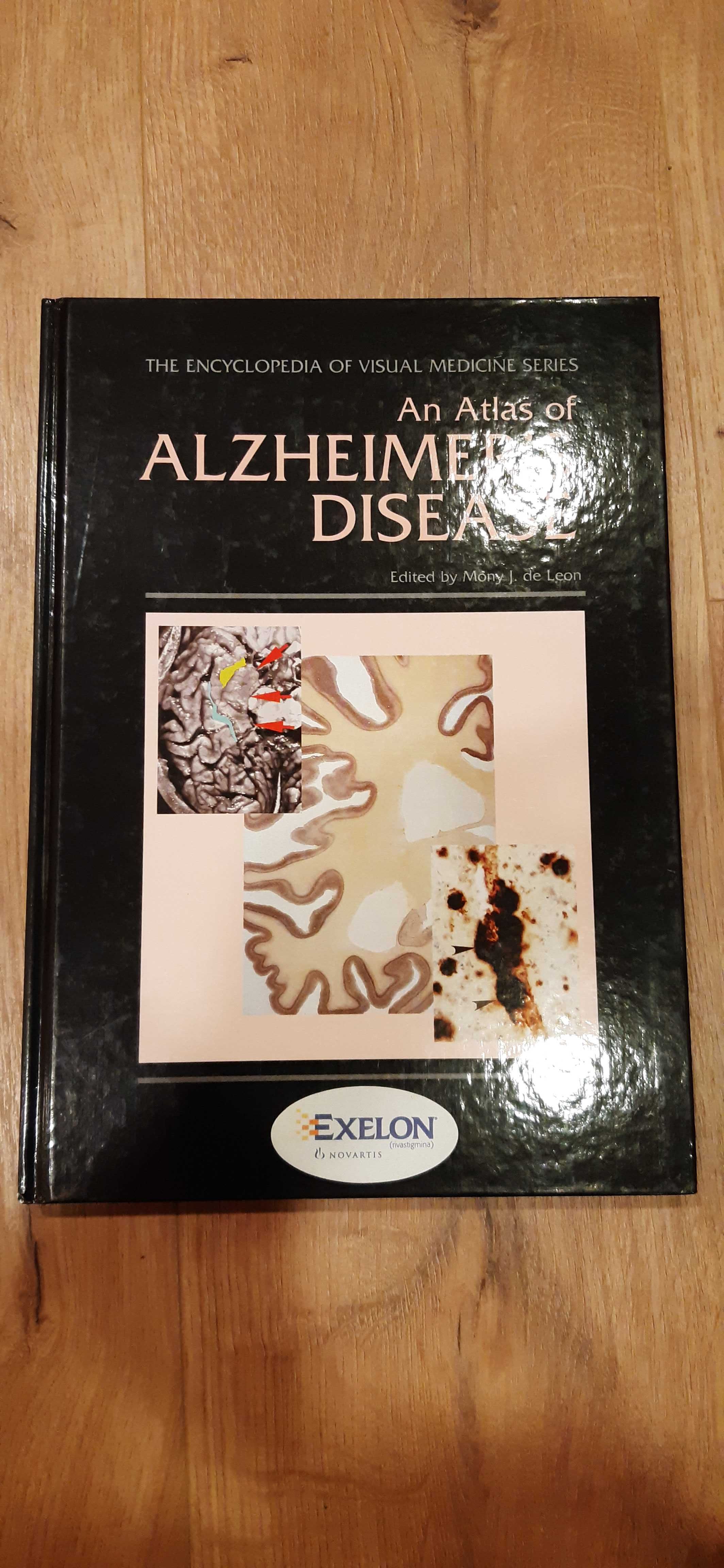 Livro Atlas of Alzheimer's disease