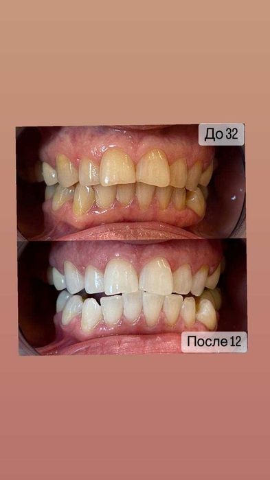 Косметичний бізнес / Франшиза відбілювання зубів Smile LAB