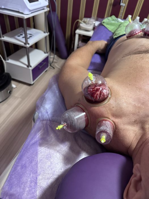 Ударно волновая экстракорпоральная радиальная терапия, аппарат 12 BAR