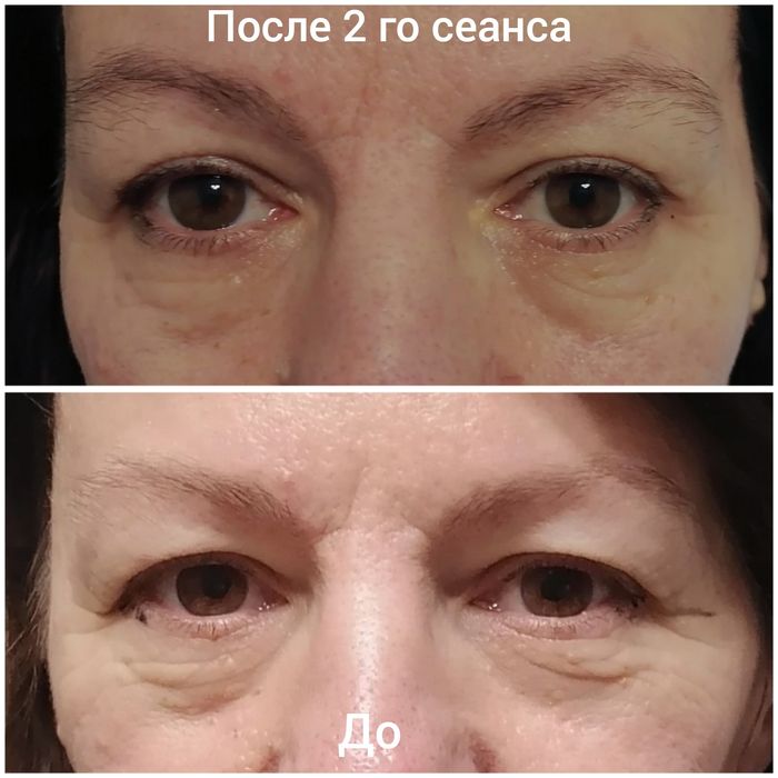 Massage. Массаж тіла та обличчя