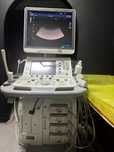 УЗД Toshiba Aplio 400 (TUS-A400)