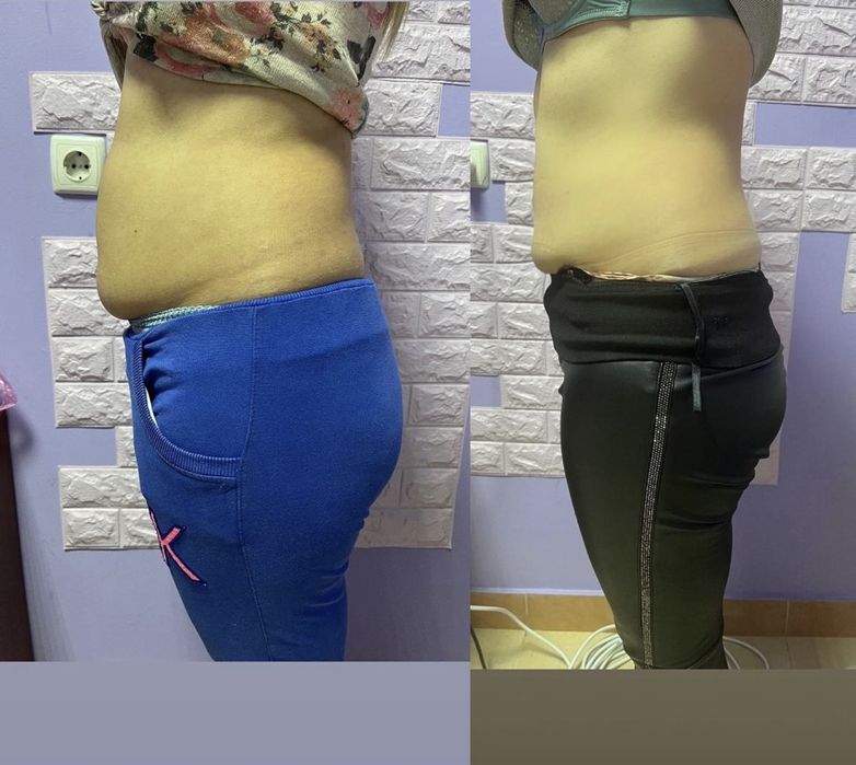 Послуги масажу. Та курси навчання масажу.