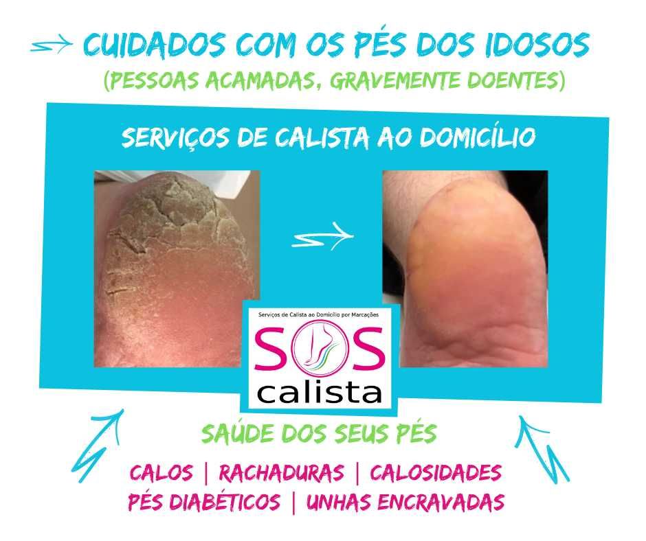 Calista ao Domicílio ou no Gabinete (Benfica)