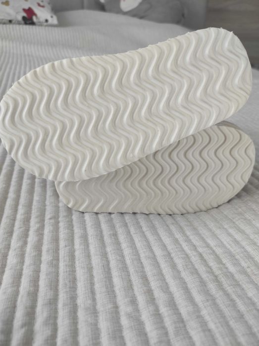 Уги на дівчинку.