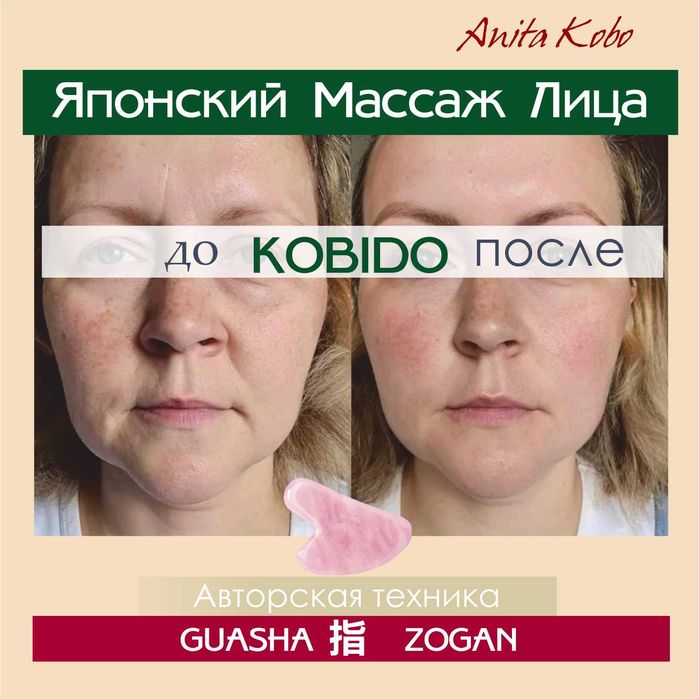 Японский Массаж лица Кобидо | метро Осокорки/Позняки | Масаж обличчя