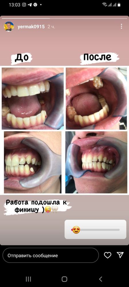 Стоматолог загальної практики при інституті Д.Ф.Чеботарьова.