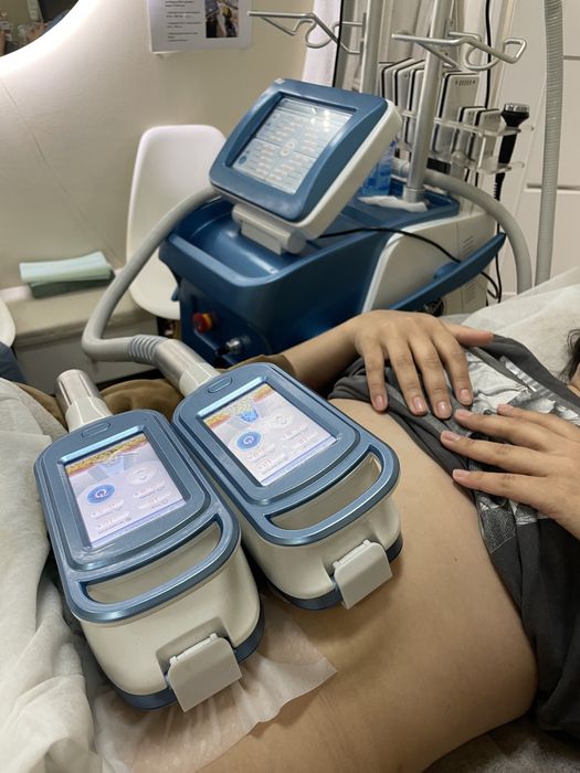 Кріоліполіз, кавітація, обгортання, ролик