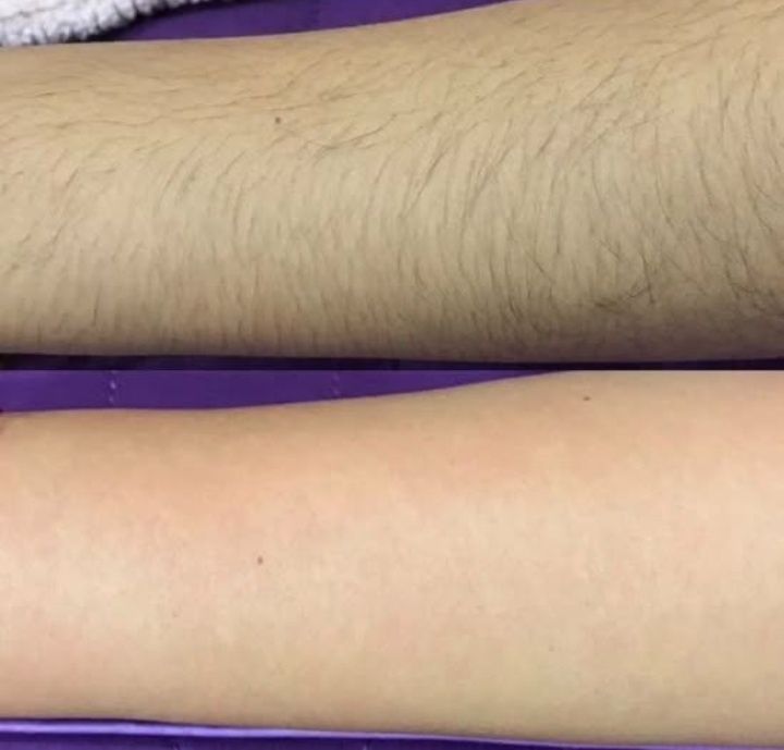 Депіляція (Піски) Депиляция воском(Пески)