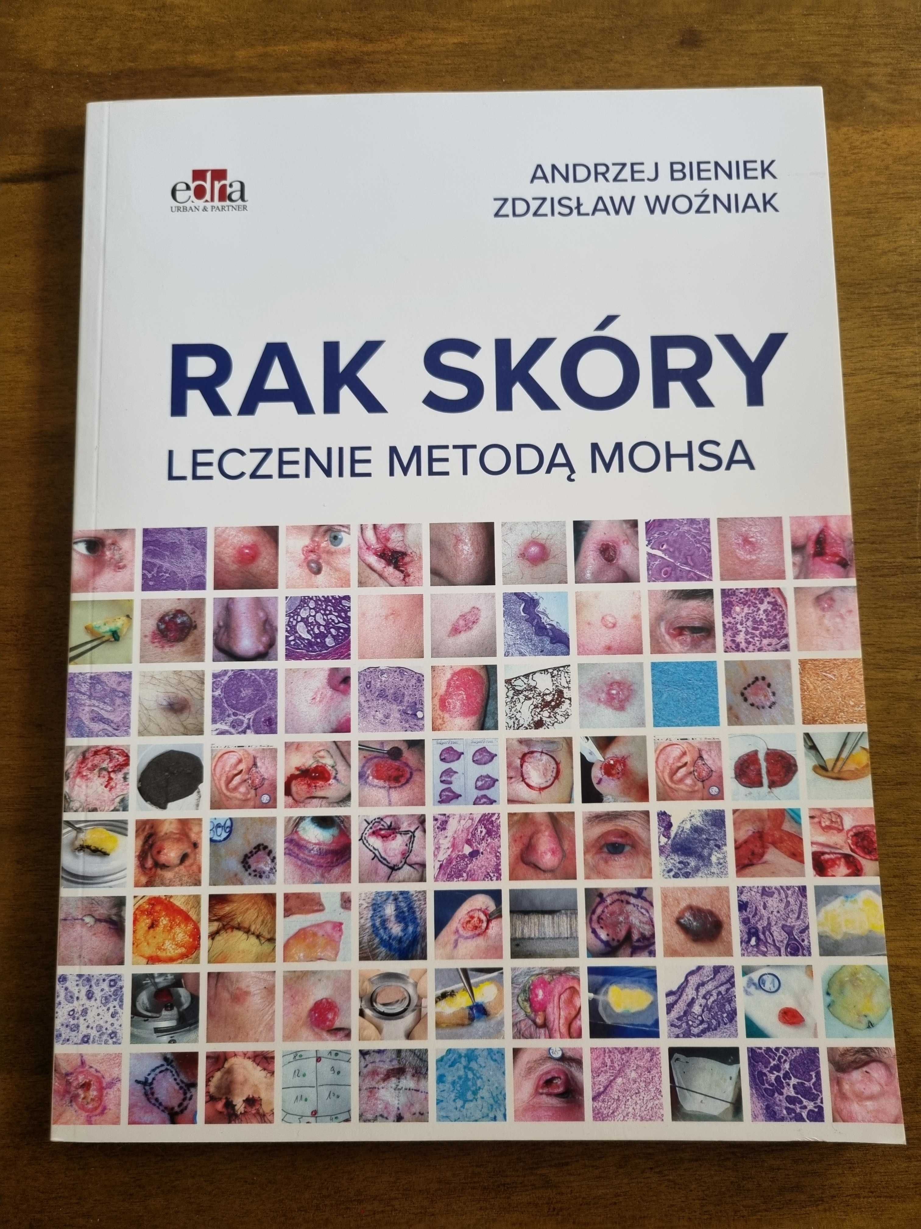 Nowa książka "Rak skóry leczenie metodą Mohsa" A. Bieniek, Z. Woźniak