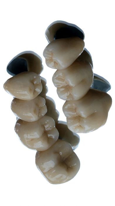 Услуги зубного техника