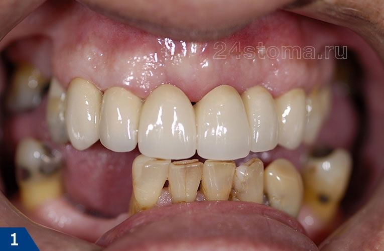 Зубний Технік…..