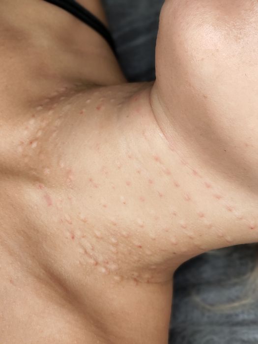 Косметолог Чистка лица Днепр Пр. Поля