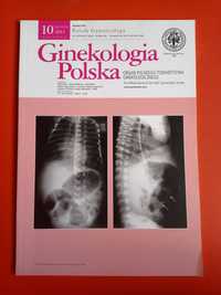 Ginekologia Polska, nr 10/2013, październik 2013