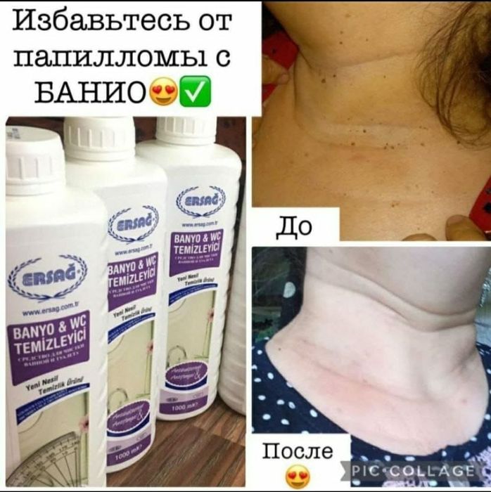 Продам баньо banyo Ersag