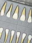 Dentes Medicina Dentária Morfologia Anatomia
