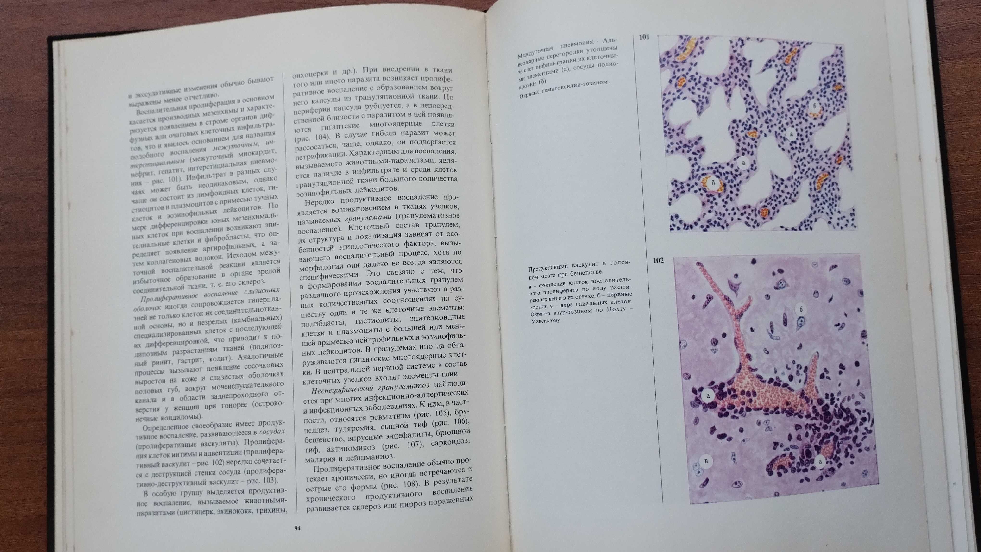 Атлас паталогической гистологии (Струков)