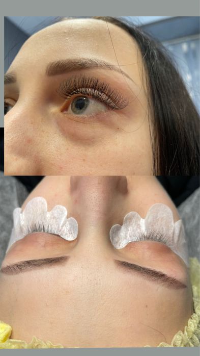 Електроепіляція, шугаринг,лазерна епіляція