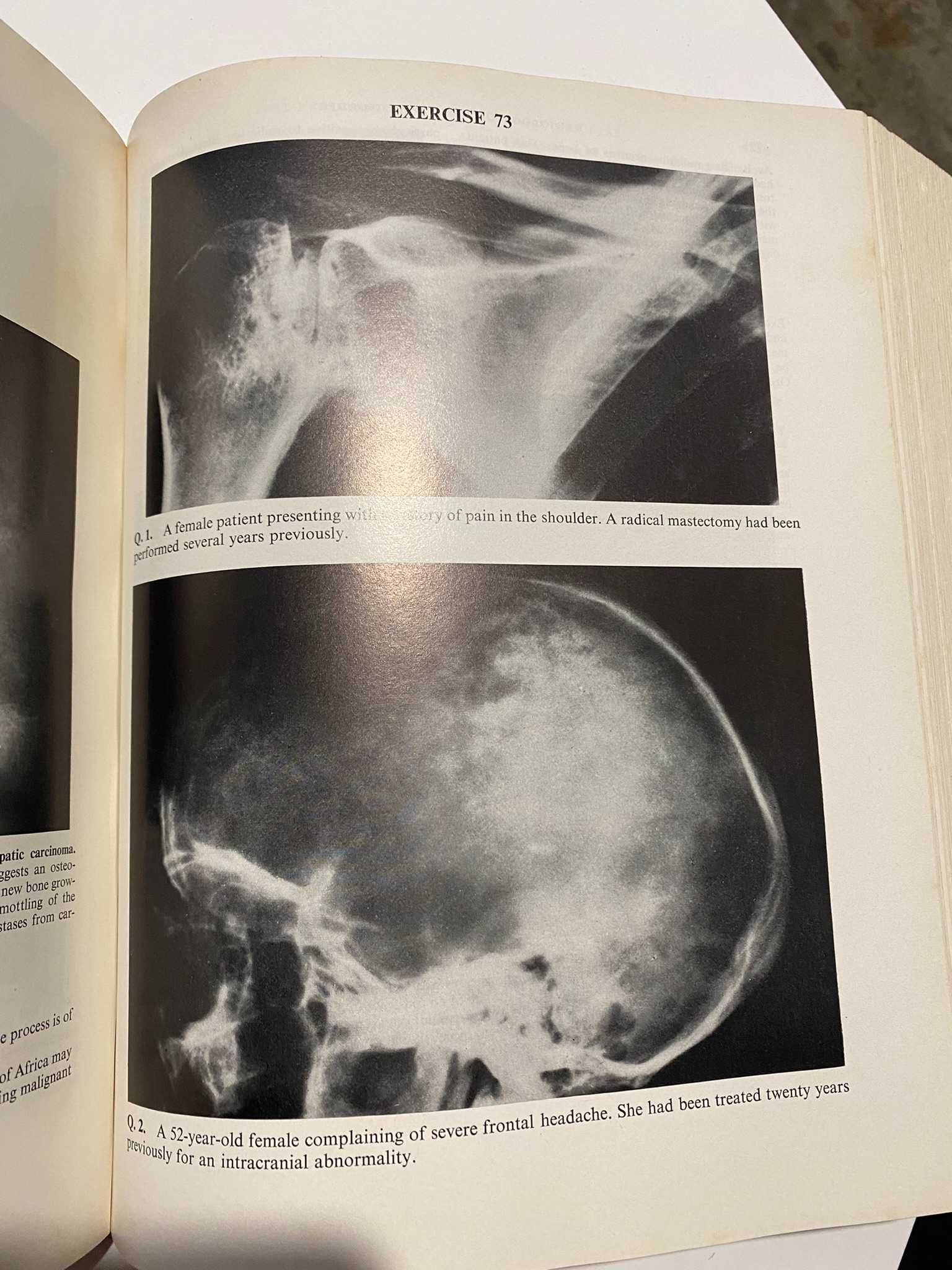 Livro de Radiologia de 1971 com mais de 1000 páginas