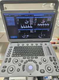USG ultrasonograf medyczny Sonoscape E2 idealny
