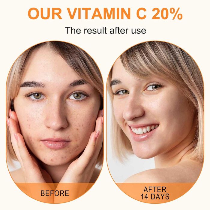 Vitamina C Serum 30ml Natural e Vegano cuidado da pele e rosto