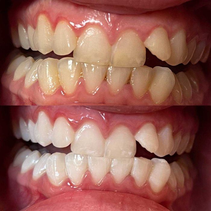 Косметичний бізнес / Франшиза відбілювання зубів Smile LAB