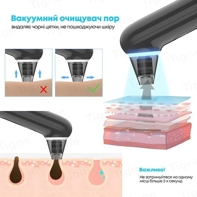Вакуумний очисник пор 3в1 XPREEN XPRE202 з функцією LED-терапія