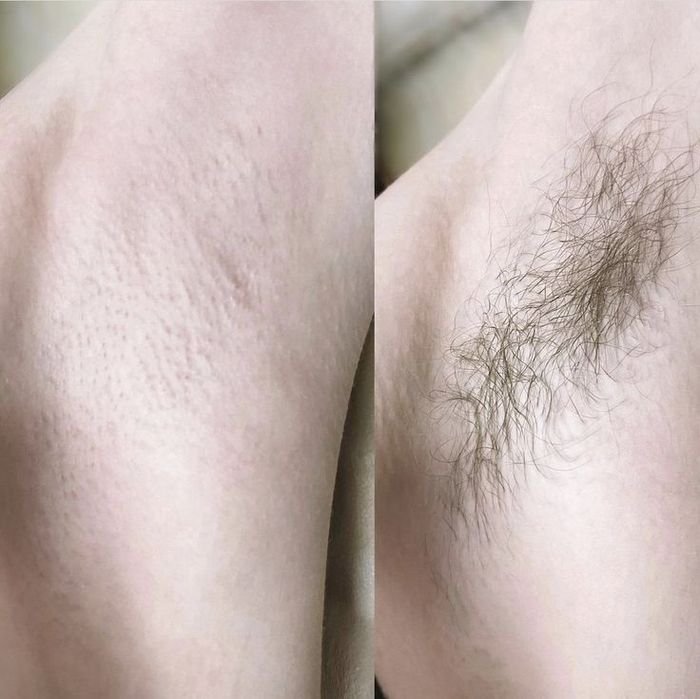 Шугаринг. Депіляція воском. Жіноча та чоловіча.  Дрогобич