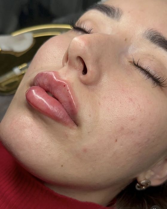 Косметологія • інʼєкції • чистка • пілінги • 5-й Зарічний • UPGRACE