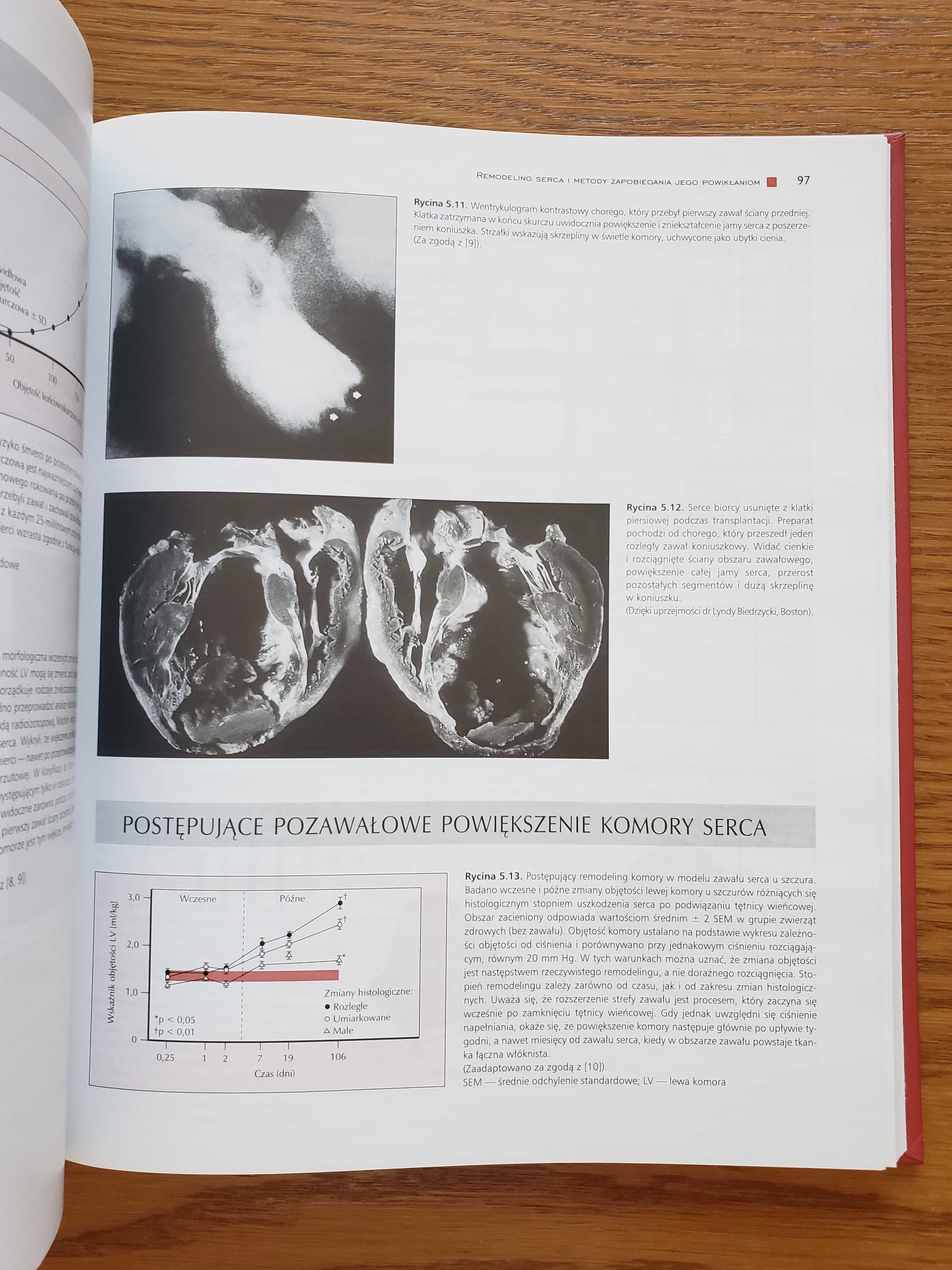 Atlas niewydolności serca pod red. W. Colucciego i E. Braunwalda