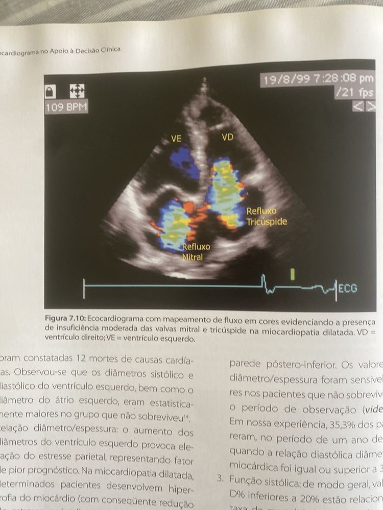 O Ecocardiograma no Apoio à Decisão Clinica