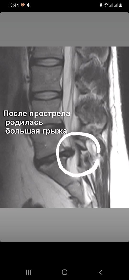 Лечение грыж,Остеопатия,Кинезиология,Мануальная терапия,PRP терапия