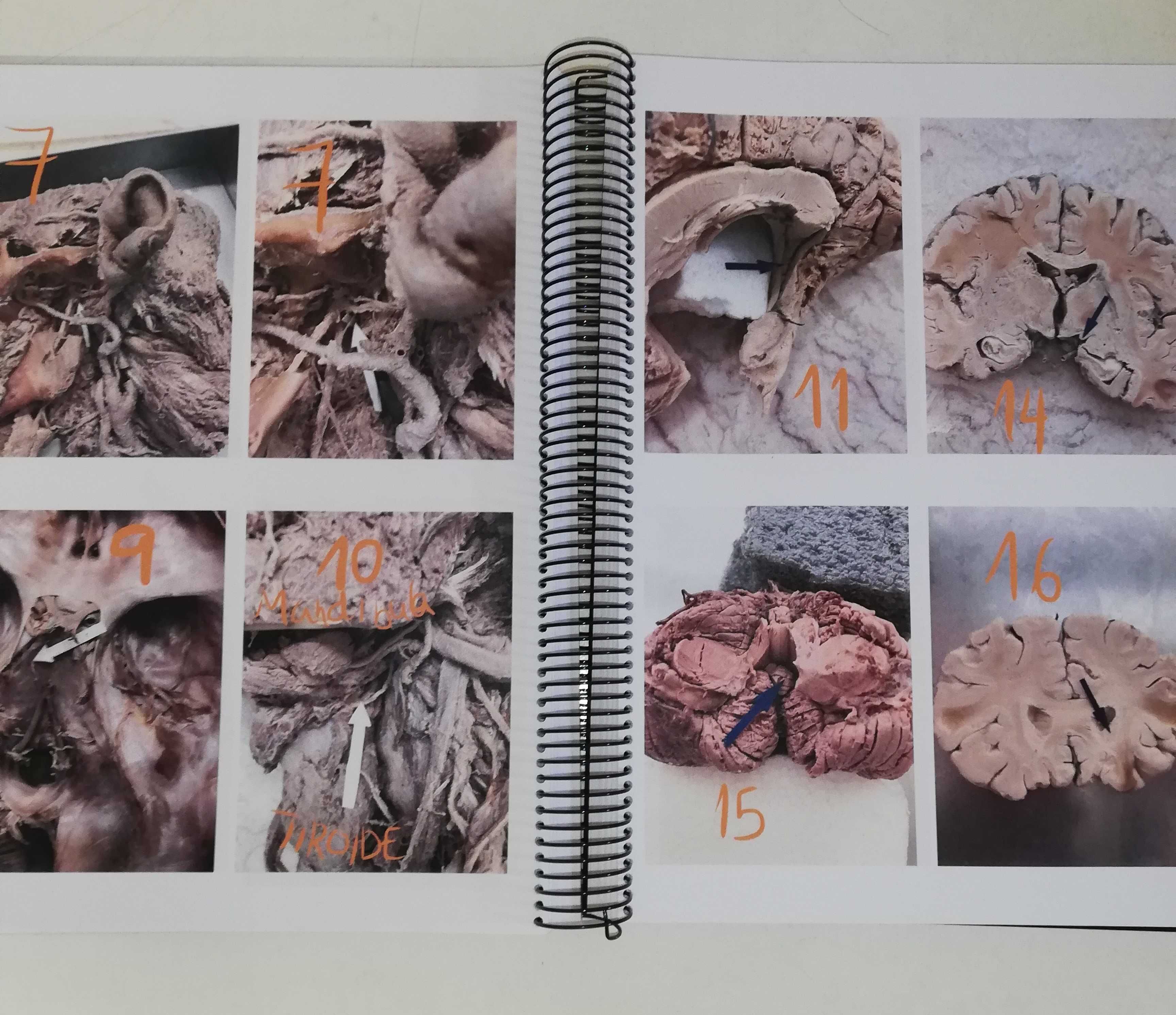 Atlas de Neuroanatomia