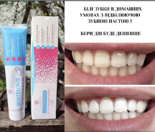 Зубна паста Білосніжна посмішка Livesta, 170 г