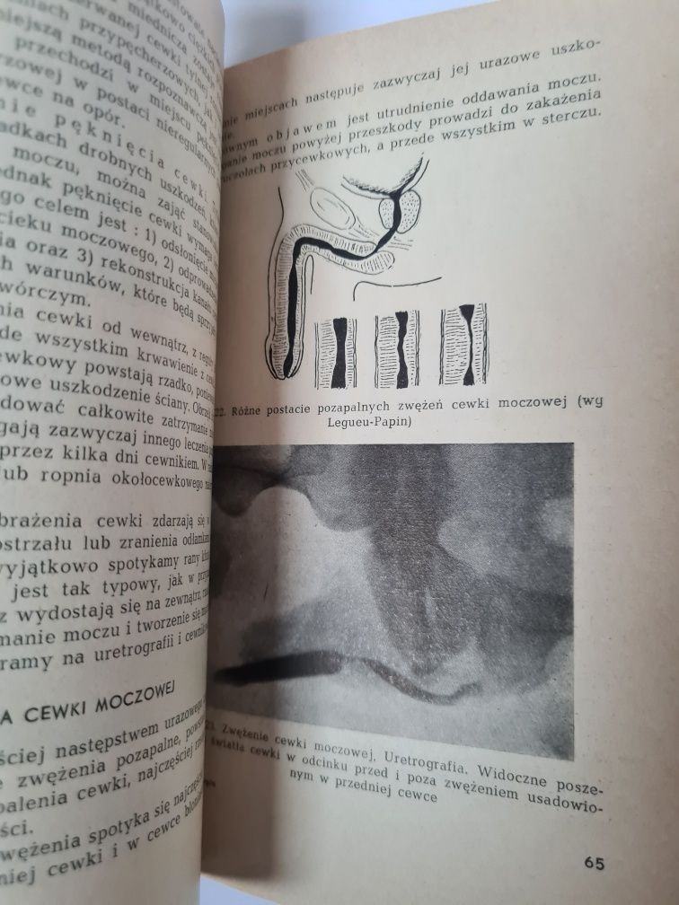 Urologia - Emil Michałowski, Wojciech Modelski. Książka