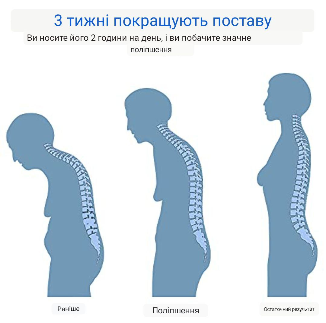 Коректор постави