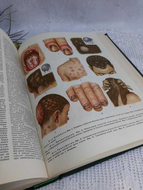 Популярная медицинская энциклопедия 1979 Петровский (Аборт - Ящур)