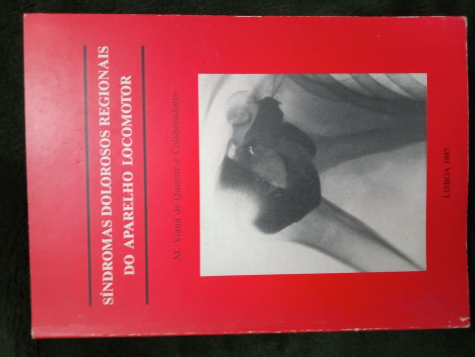 Síndromas dolorosos regionais do aparelho locomotor- QUEIROZ, M. Viana