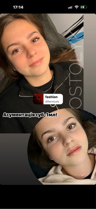 Перманентний макіяж/збільшення губ/розчинення