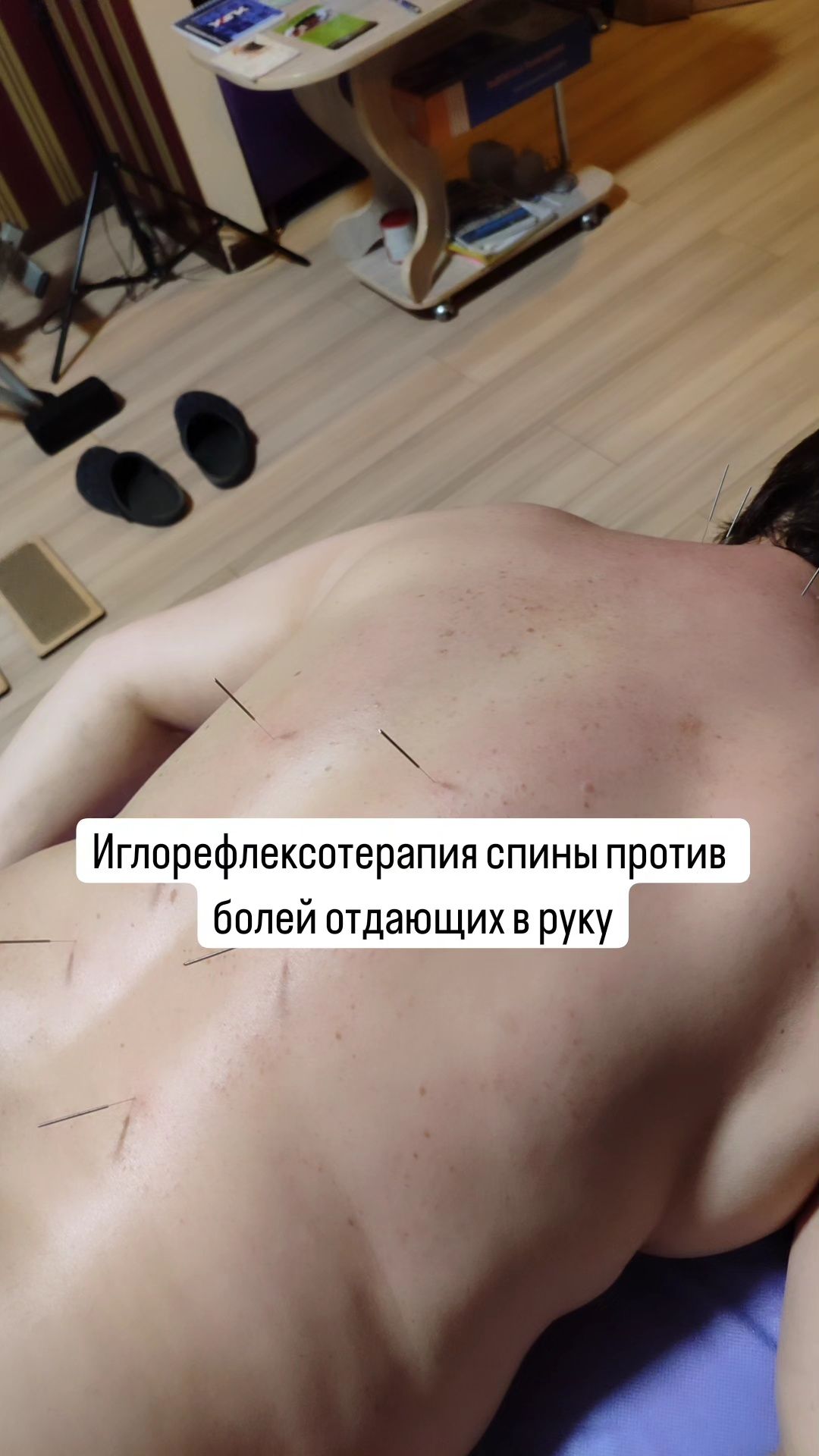 Иглорефлексотерапия, акупунктура. Хиджама,Доктор восточной медицины