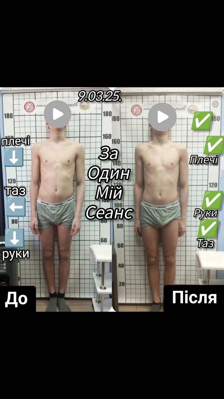 Професійний масаж.Остеоратія