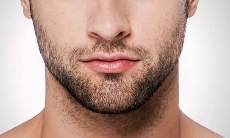 NEW ORIGINAL Minox 5% Засіб для росту волосся та бороди 60ml