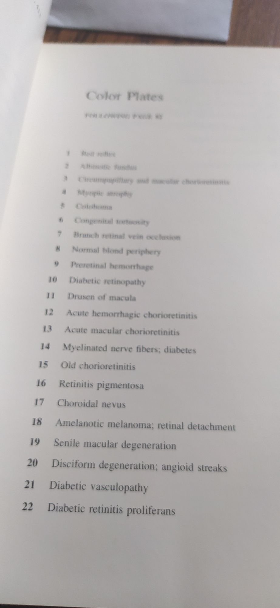 Synopsis of Ophthalmology the Ophthalmoscopy Book William H. Havener