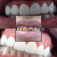 Естетична стоматологія
