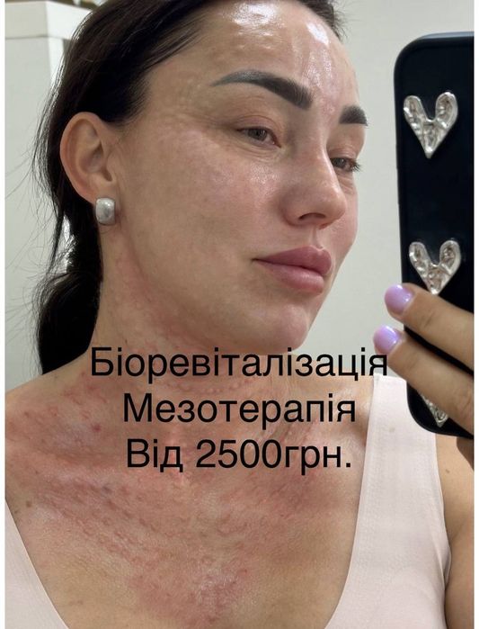 Косметолог Харківський рн.метро Вирлиця