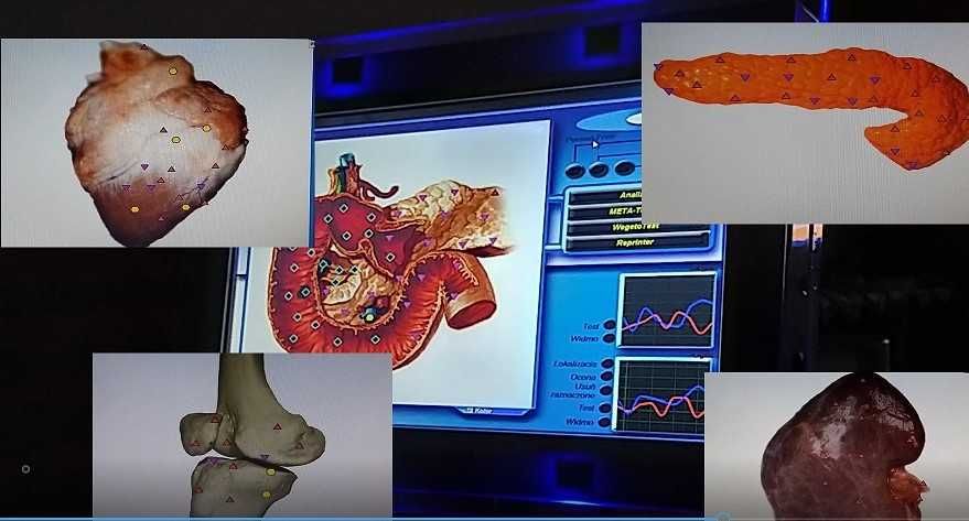 Badanie Biorezonansem-Diagnostyka Skanerem 3D - NEOMED Śląsk