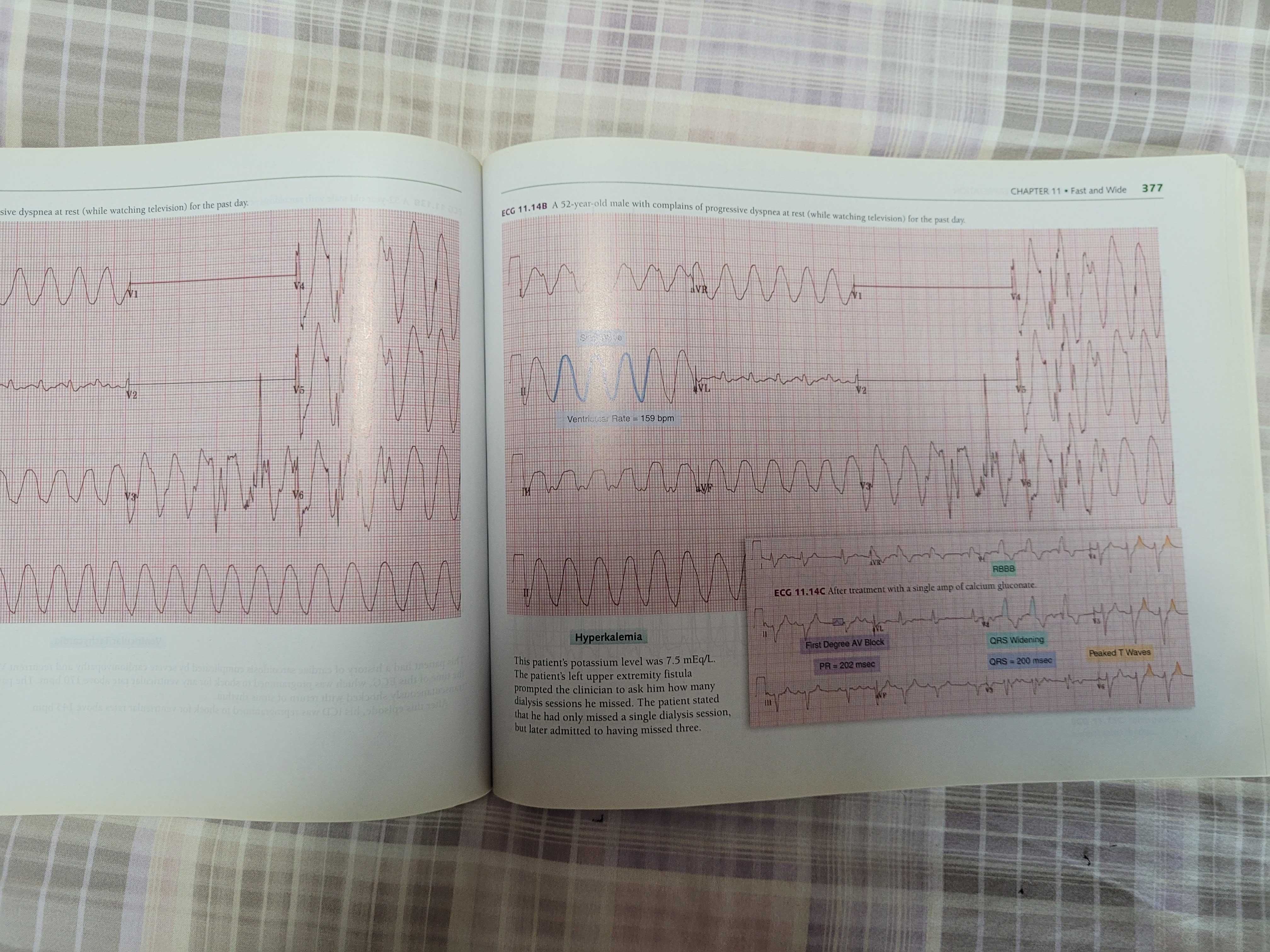 Medicina "A visual Guide to ECG interpretation" da Wolters Kluwer