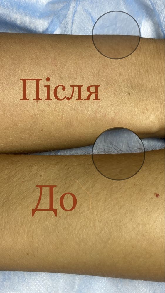 Шугаринг/ваксинг Рівне чоловіки та жінки